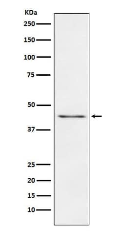 Carboxypeptidase A1/A2/B1 Antibody (SR1745), Novus Biologicals:Antibodies:Primary