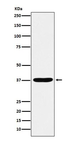 AKR1C1/2 Antibody (SR1611), Novus Biologicals:Antibodies:Primary Antibodies