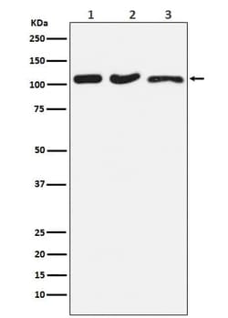 DISC1 Antibody (SR1013), Novus Biologicals 50 &mu;g; Unconjugated:Antibodies,