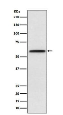 LCAT Antibody (SR1989), Novus Biologicals 100 &mu;g; Unconjugated:Antibodies,