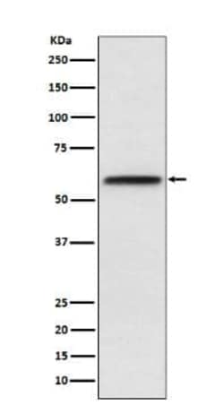 LCAT Antibody (SR1989), Novus Biologicals 100 &mu;g; Unconjugated:Antibodies,