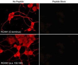 RCAN1 Antibody, Novus Biologicals 0.1 mL, Unconjugated:Antibodies, Polyclonal