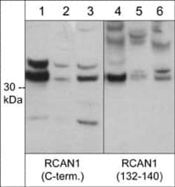 RCAN1 Antibody, Novus Biologicals 0.1 mL, Unconjugated:Antibodies, Polyclonal