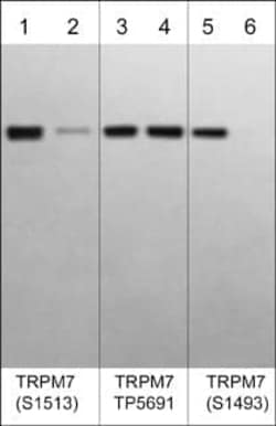 TRPM7 Antibody, Novus Biologicals 0.1 mL, Unconjugated:Antibodies, Polyclonal