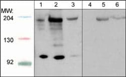 ROBO1 Antibody, Novus Biologicals 0.1 mL, Unconjugated:Antibodies, Polyclonal