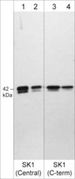 Sphingosine Kinase 1/SPHK1 Antibody, Novus Biologicals 0.1 mL | Buy Online | Novus Biologicals | Fisher Scientific