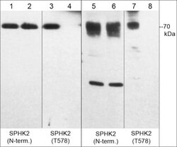 Sphingosine Kinase 2/SPHK2 Antibody, Novus Biologicals 0.1 mL | Buy Online | Novus Biologicals | Fisher Scientific