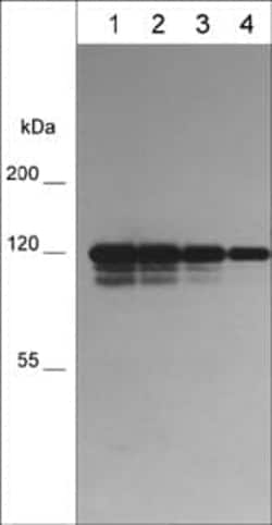 P-Cadherin Antibody (M596), Novus Biologicals 0.1 mL, Unconjugated:Antibodies,