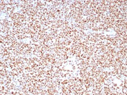 PMS2 Antibody (PMS2/8224R), Novus Biologicals 20 &mu;g | Buy Online | Novus Biologicals | Fisher Scientific