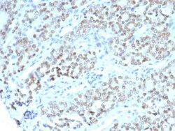 BTBD9 Antibody (BTBD9/7501), Novus Biologicals:Antibodies:Primary Antibodies