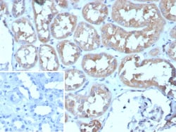 Adenylate Cyclase 8 Antibody (ADCY8/7573), Novus Biologicals 100 &mu;g,