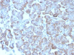Adenylate Cyclase 8 Antibody (ADCY8/7573), Novus Biologicals 100 &mu;g,