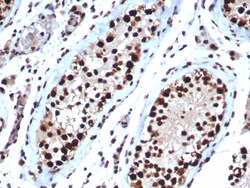 HspA1B Antibody (HSPA1B/7623), Novus Biologicals:Antibodies:Primary Antibodies
