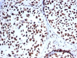 HspA1B Antibody (HSPA1B/7625), Novus Biologicals:Antibodies:Primary Antibodies