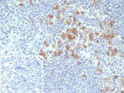 CD38 Antibody (CD38/8075R), Novus Biologicals 20 &mu;g | Buy Online | Novus Biologicals | Fisher Scientific