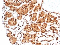 HspA1B Antibody (HSPA1B/7628), Novus Biologicals:Antibodies:Primary Antibodies