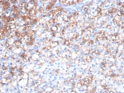 HSP27 Antibody (rHSPB1/7298), Novus Biologicals:Antibodies:Primary Antibodies