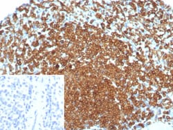 CD74 Antibody (rCLIP/8679), Novus Biologicals:Antibodies:Primary Antibodies