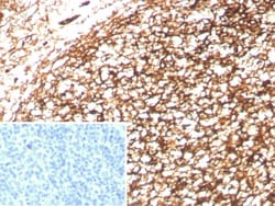 CD35 Antibody (CR1/8833R), Novus Biologicals 20 &mu;g, Unconjugated:Antibodies,