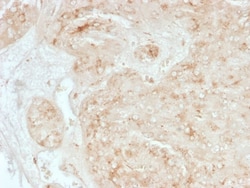 StAR Antibody (STAR/3976), Novus Biologicals 20 &mu;g, Unconjugated:Antibodies,