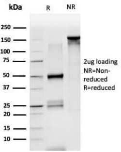 LDB2 Antibody (PCRP-LDB2-1B10), Novus Biologicals 20 &mu;g | Buy Online | Novus Biologicals | Fisher Scientific