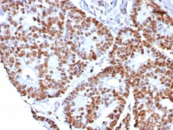Nucleolin Antibody (NCL/8068R), Novus Biologicals 100 &mu;g, Unconjugated:Anticorps,