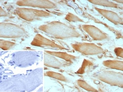 ZNF804A Antibody (ZNF804A/8945), Novus Biologicals 100 &mu;g, Unconjugated:Antibodies,