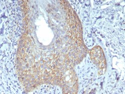 beta-Catenin Antibody (rCTNNB1/8043), Novus Biologicals:Antikörper:Primärantikörper