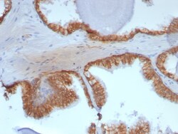 beta-Catenin Antibody (rCTNNB1/8043), Novus Biologicals:Antikörper:Primärantikörper