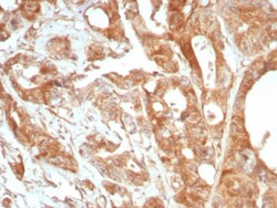 Podoplanin Antibody (PDPN/8875R), Novus Biologicals 100 &mu;g, Unconjugated:Anticuerpos