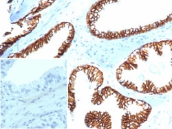 beta-Catenin Antibody (CTNNB1/6807R), Novus Biologicals:Antibodies:Primary