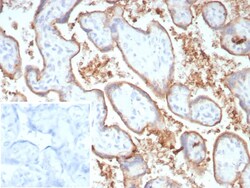 PD-L1 Antibody (PDL1/8809R), Novus Biologicals 20 &mu;g | Buy Online | Novus Biologicals | Fisher Scientific