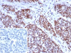 MSH6 Antibody (rMSH6/8337), Novus Biologicals 20 &mu;g, Unconjugated:Antibodies,