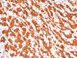 ALDH1L1 Antibody (ALDH1L1/7702), Novus Biologicals 100 &mu;g, Unconjugated:Antibodies,