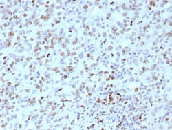 MLH1 Antibody (rMLH1/8630), Novus Biologicals 100 &mu;g, Unconjugated:Antibodies,