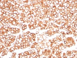 MDR1/ABCB1 Antibody (MDR1/8962R), Novus Biologicals:Antibodies:Primary