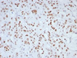 MLH1 Antibody (MLH1/8855R), Novus Biologicals:Antibodies:Primary Antibodies