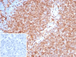 HLA DQ/DR/DP Antibody (HLA-Pan/8311R), Novus Biologicals 20 &mu;g, Unconjugated:Antibodies,