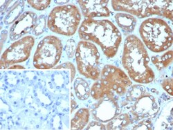 RHOBTB2 Antibody (DBC2/4570), Novus Biologicals:Antibodies:Primary Antibodies
