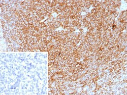 HLA DQ/DR/DP Antibody (HLA-Pan/8622R), Novus Biologicals:Antibodies:Primary
