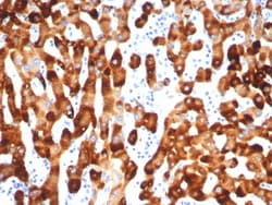HBsAg Antibody (HBsAg/7556R), Novus Biologicals 20 &mu;g, Unconjugated:Antibodies,