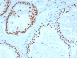 Androgen R/NR3C4 Antibody (DHTR/4929R), Novus Biologicals:Antibodies:Primary