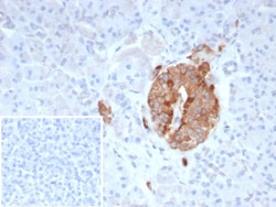 Collagen IV Antibody (COL4/9395R), Novus Biologicals 100 &mu;g, Unconjugated:Antibodies,