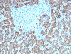 CPS1 Antibody (CPS1/8417), Novus Biologicals 100 &mu;g, Unconjugated:Antibodies,