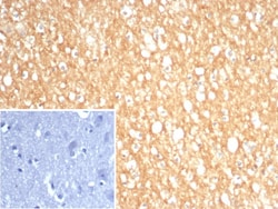S100A5 Antibody (S100A5/7474), Novus Biologicals 100 &mu;g, Unconjugated:Antibodies,