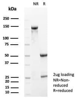 S100A5 Antibody (S100A5/7474), Novus Biologicals 100 &mu;g, Unconjugated:Antibodies,