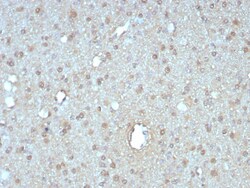 GIRK2 Antibody (KCNJ6/7558), Novus Biologicals:Antibodies:Primary Antibodies