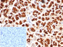 GIRK2 Antibody (KCNJ6/7558), Novus Biologicals:Antibodies:Primary Antibodies