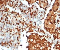 S100G Antibody (S100G/7462), Novus Biologicals:Antibodies:Primary Antibodies