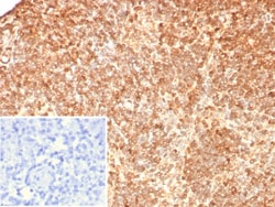 S100G Antibody (S100G/7517), Novus Biologicals:Antibodies:Primary Antibodies